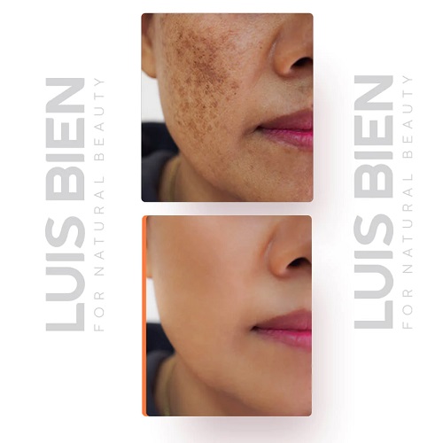 Luis Bien Cilt Tonu Eşitleyici Leke Karşıtı Krem 50 gr