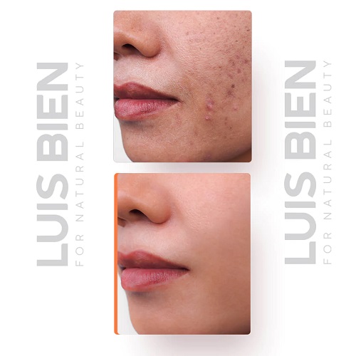 Luis Bien Cilt Tonu Eşitleyici Leke Karşıtı Krem 50 gr